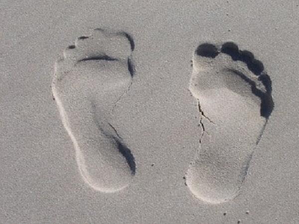 Ako na ploché nohy: príčiny, prevencia a liečba