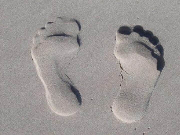 Ako na ploché nohy: príčiny, prevencia a liečba